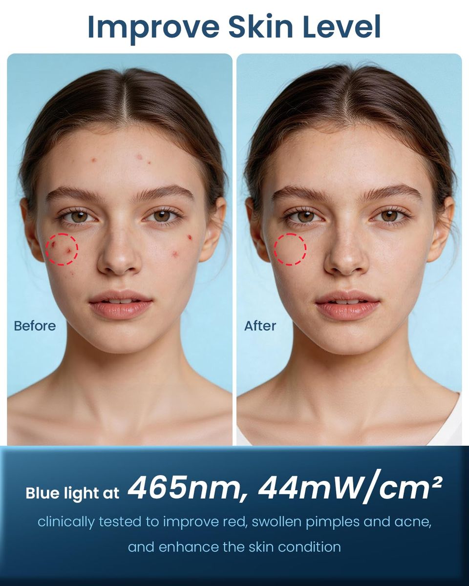 MISFANS Jorking FDA-Cleared Red Light Therapy Mask