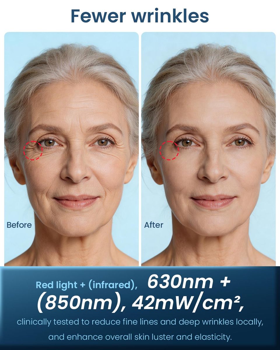 MISFANS Jorking FDA-Cleared Red Light Therapy Mask
