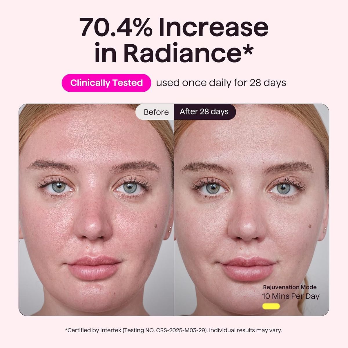 Wavytalk Red Light Therapy Mask: Glow Time for Radiant Skin